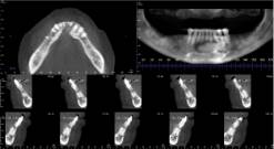 radiology image