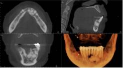 radiology image