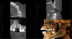 radiology image