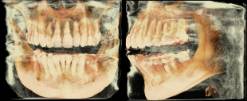 3d CT image