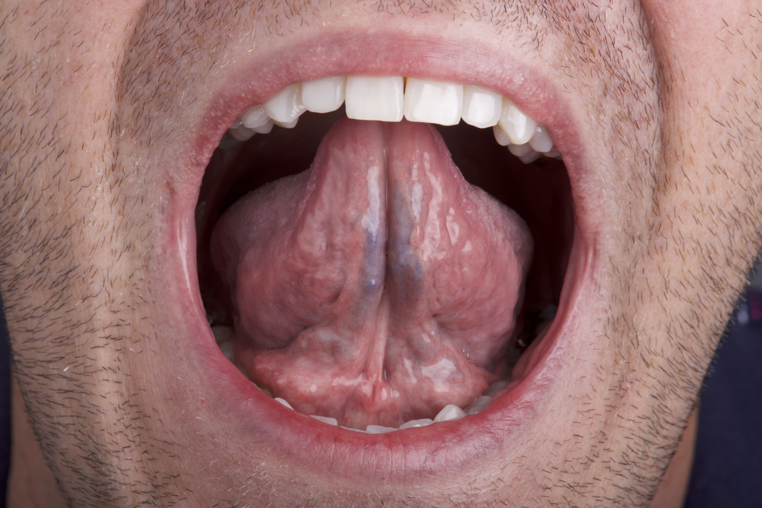 what does a healthy tongue look like